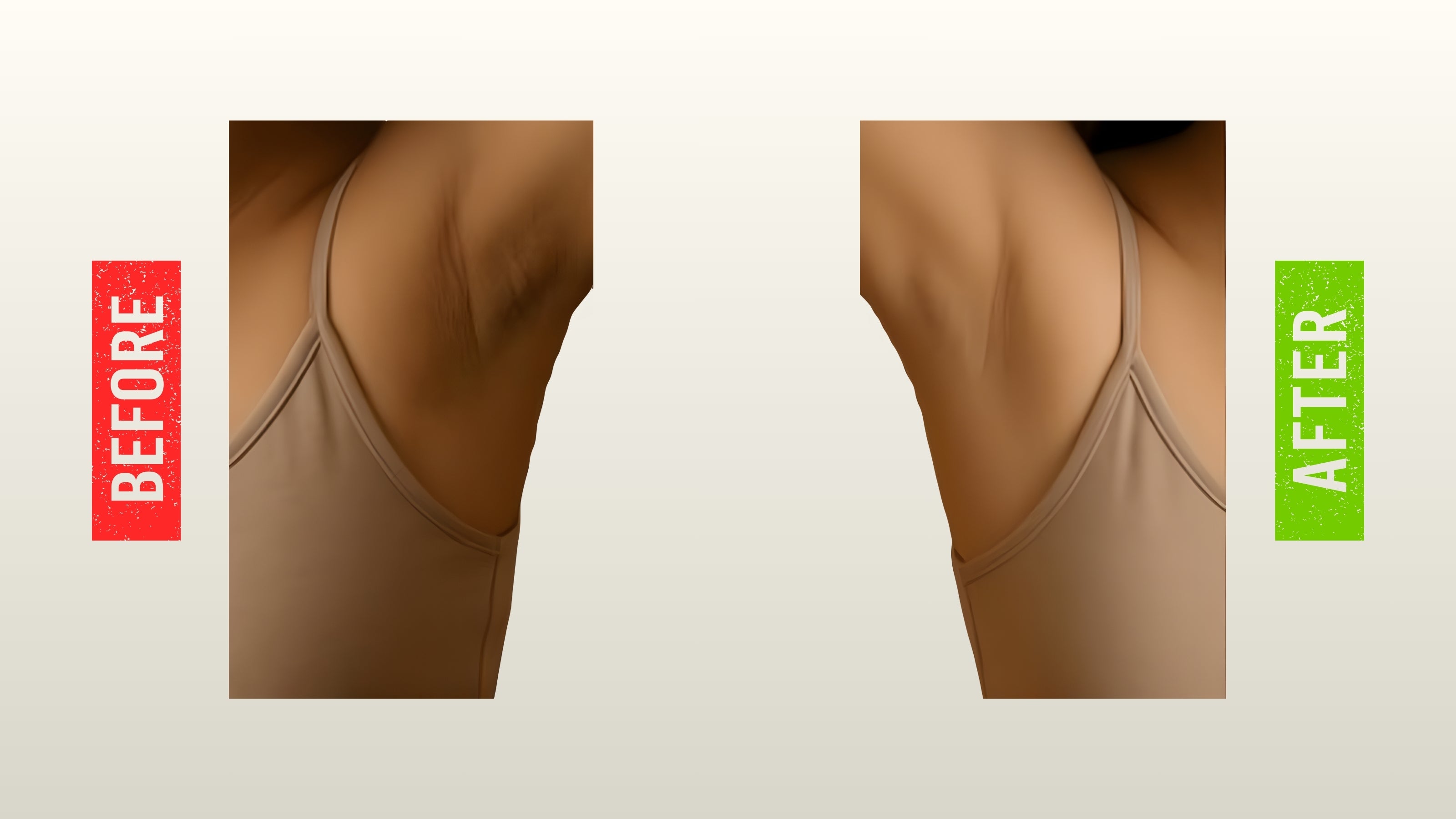 Before and after underarm skin improvement showing reduced dark patches and clearer, smoother skin using Dr AK Formula Cream