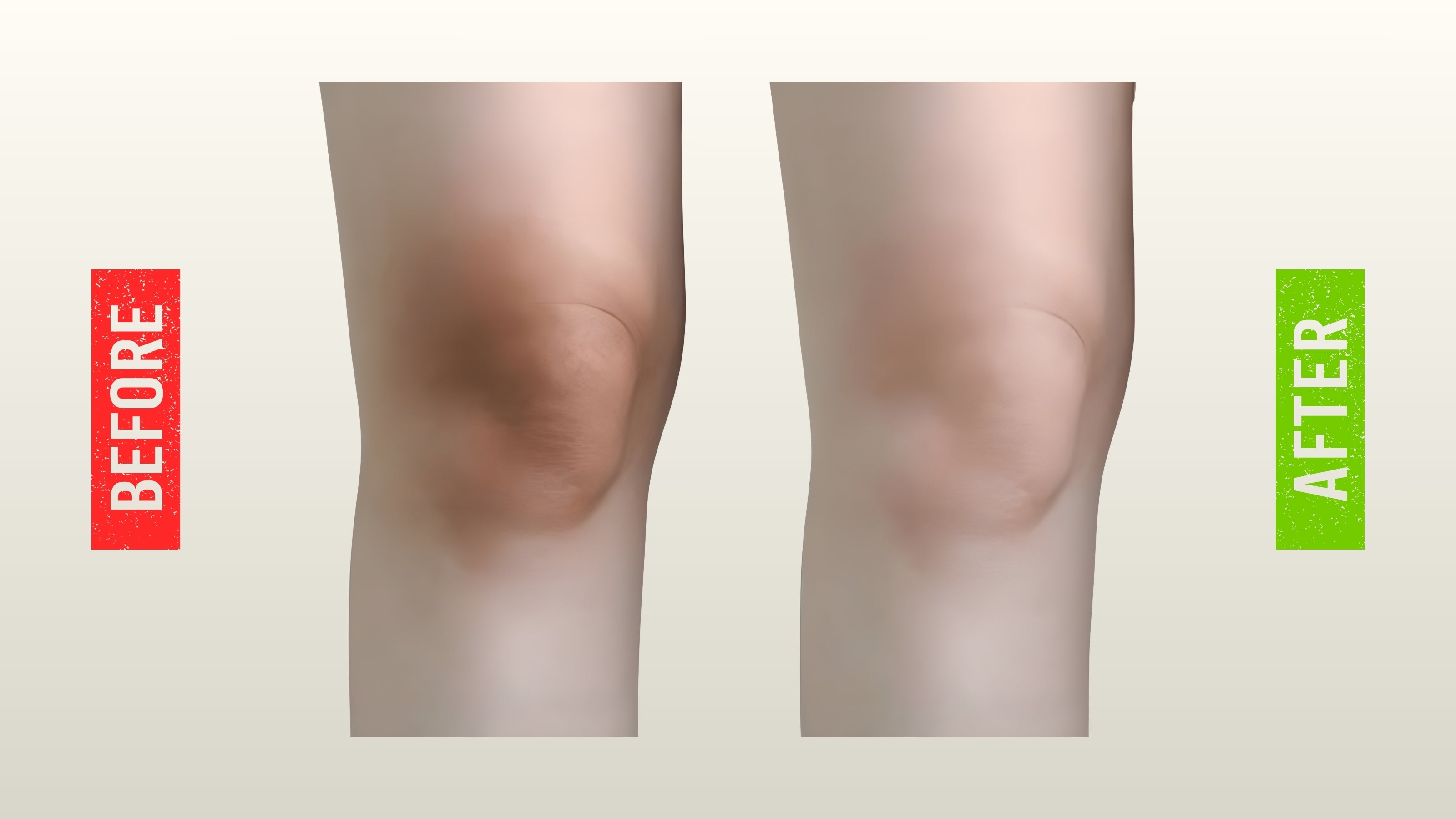 Before and after skin improvement showing brighter, smoother, and clearer knee area using Dr AK Formula Cream